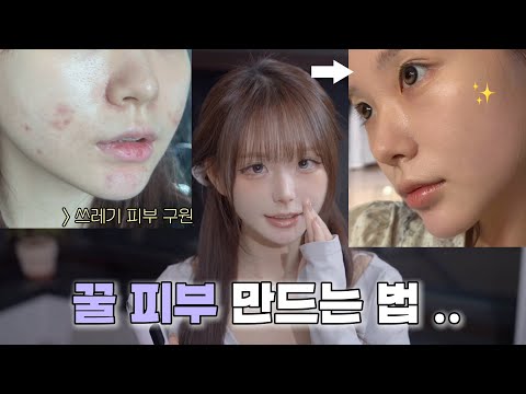 저 쓰레기 피부 탈출했어요 … 🥹