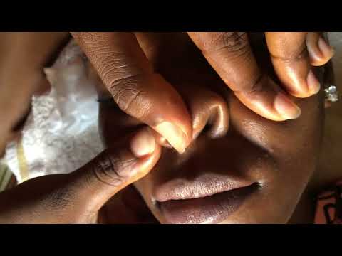 Asmr - Nitpicking her face for a good sleep #asmreating #asmrsleep #satisfying