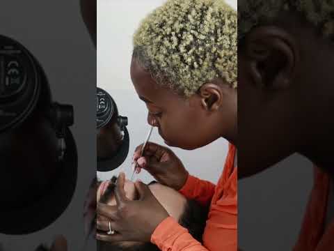 Nitpicking WHITEHEADS around his face and nose | FULL VIDEO UPLOADED LAST FRIDAY #asmr #shortsvideo