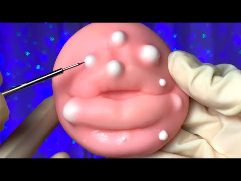 ASMR REMOVENDO SUAS ESPINHAS | CUIDADOS FACIAIS | SATISFATÓRIO