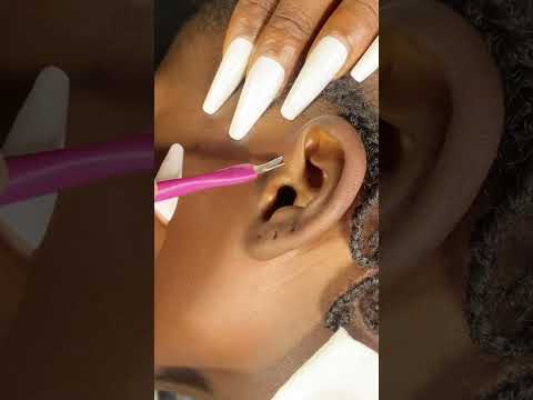 ASMR RELAXING EAR CLEANING, FACE PICKING, SCALP SCRATCHING, HAIR PLAY, GUM CHEWING|