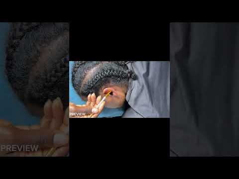 ASMR Ear Cleaning, Back Scratching, Ear Scratching & Nitpicking for Deep Sleep | E Relaxing Sounds