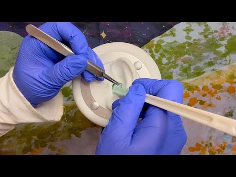 ASMR | Wet & Dry Ear Wax Extraction - Limited Soft Spoken, Visual Triggers