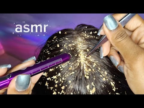 ASMR CASPA - TIRANDO CASPA DO SEU CABELO COM CÂMERA ZOOM 📷 (com voz suave) 