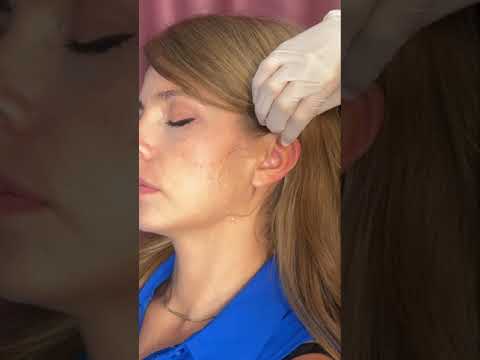 Asmr ear 👂 exam #asmr #relax #relaxing #asmrsounds #asmrvideo #tingles #medical #satisfying #sleep