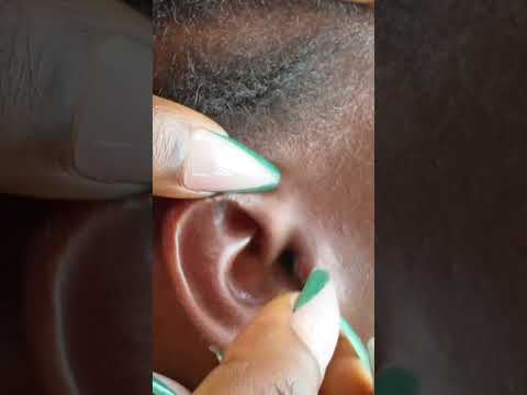 Asmr Ear Cleaning Real Person #asmr #tingling #nails #relax #earcleaning #satisfying