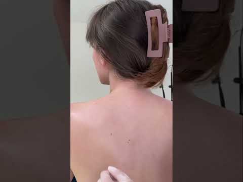 Asmr back exam #asmr #asmrsounds #asmrvideo #relaxing #relax #satisfying #satisfyingvideo #tingles