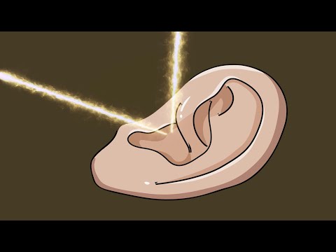 𝗔𝗦𝗠𝗥 고객님, 시술 후 바로 팅글 돌아옵니다.
