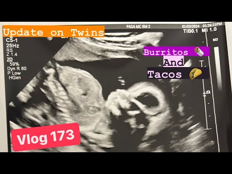 Vlog #173 - Update Twin Ultrasound Appointment (17weeks)