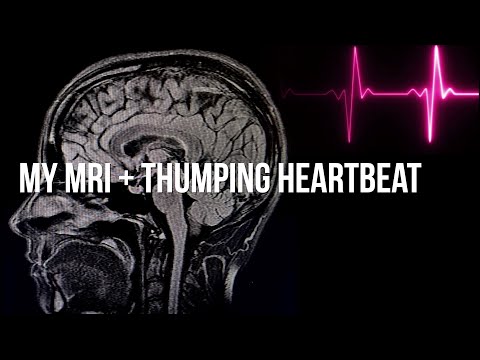 ASMR Female Heartbeat | My Brain MRI Images & Radiology Report