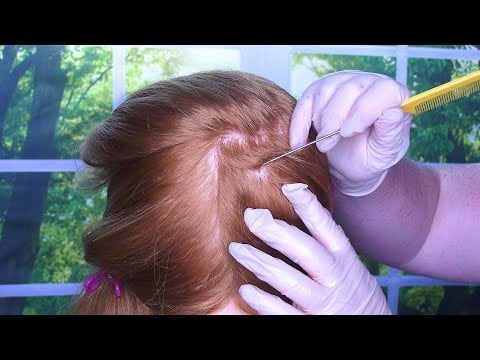 ASMR Scalp Check and Treatment (Scalp Scratching, Close Up, Minimal Talking) Relaxing Roleplay