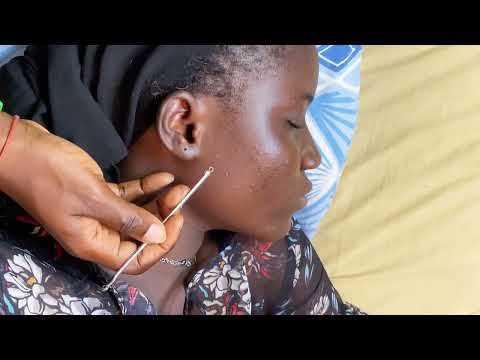ASMR FACE NITPICKING AND EAR PICKING AND CLEANING FOR SATISFYING RELAXING SLEEP