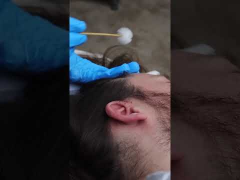 ASMR Real Person Scalp Sensation Sharp Dull Testing | unintentional medical asmr