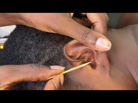 ASMR EAR CLEANING VERY SATISFYING FOR THOSE WHO NEED QUICK SLEEP WITH GUM CHEWING