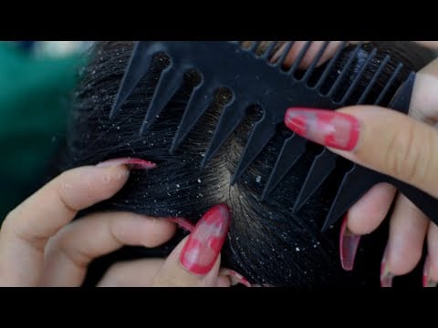 ASMR Dandruff Scratching, Dandruff Cleansing With Long Nails Relaxing For Deep Sleep ( No Talking )
