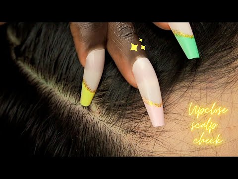 ASMR | Upclose Scalp Check Triggers With fingers ~  for sleep 😴☁️