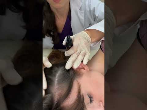 Asmr scalp tingles #asmr #asmrsounds #asmrvideo #relax #relaxing #satisfying #hair #sleep #tingles