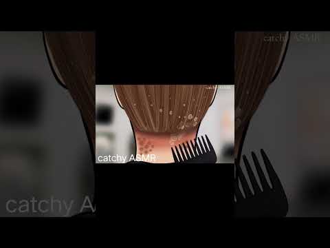 head lice and dandruff scalp treatment animation#relaxing #treatmentanimation #animation #asmrvideo