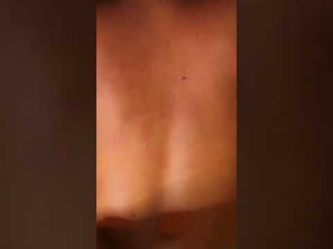 Asmr Back Nitpicking Whiteheads And massage #tingling #satisfying #asmr #skincare