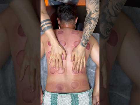 ASMR vip cupping alinezhad#shorts #asmr
