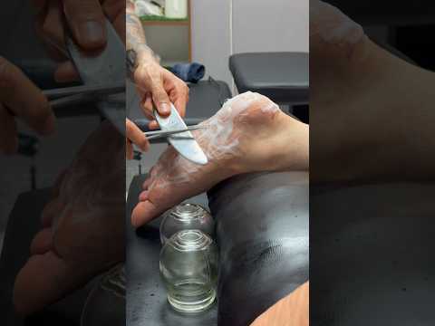 😍#shorts #asmr #cupping