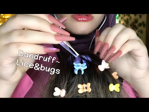 ASMR Lice Check On Wig 💆🏻‍♀️ Bugs & Dandruff Removal, Scalp Check & Scratche, Massage ✨