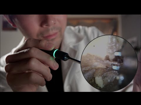 [ASMR]  大量の耳垢そうじ　耳鼻科ロールプレイ
