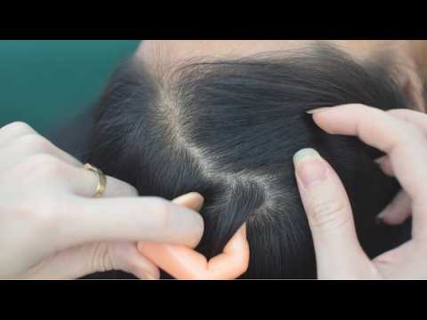ASMR Hair Parting On Real Person And Scalp Scratching Sounds, Relaxing For Stress Relief