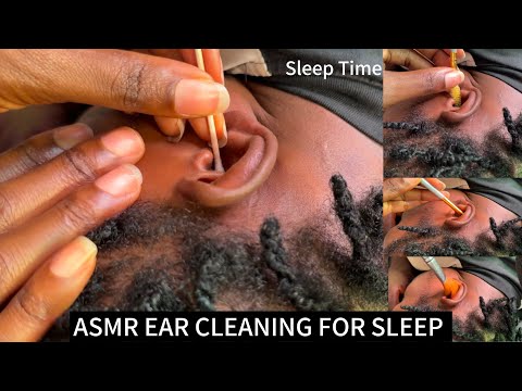 ASMR EAR CLEANING AND NITPICKING FOR THOSE WHO NEED ATTENTION NOW. QUICK SLEEP