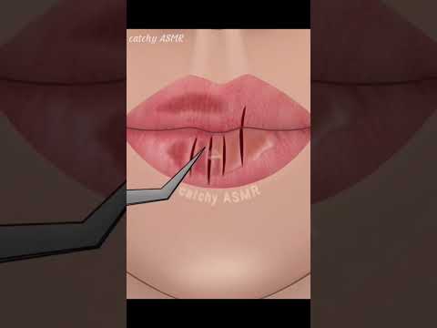 Lip care animation, Removal of dead cells of chapped lips, ASMR animation#animation #asmr #trending