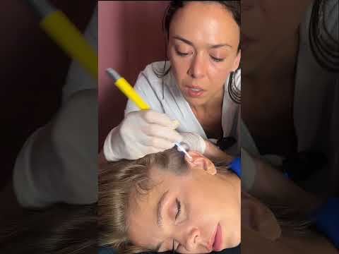 Asmr scalp tingles #asmr #asmrsounds #asmrvideo #relax #relaxing #satisfying #hair #sleep #tingles