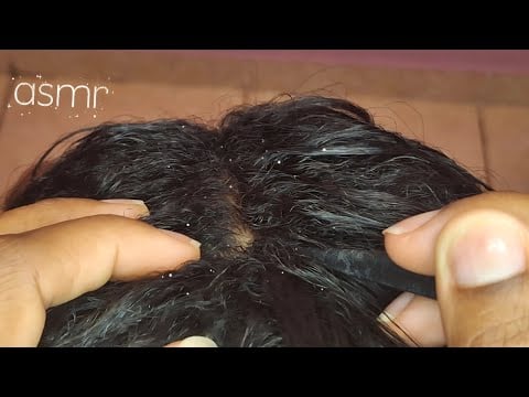 ASMR CASPA - TIRANDO CASPA DO SEU CABELO - ANALISANDO ( ASMR CASEIRO com voz suave ) 