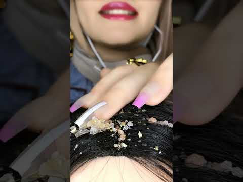 Dandruff Removal 💆🏻‍♀️🍪 #asmr #satisfying #satisfying #scratching #shorts #relaxing #canada