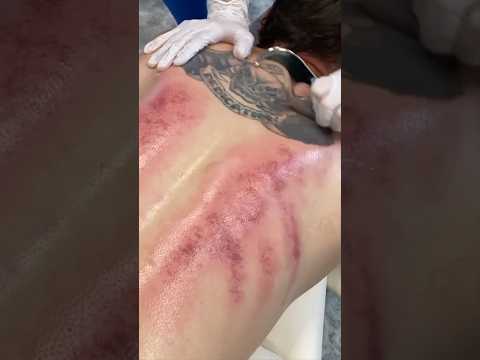 Made His Ribs CRACK on his Back #chiropractic #asmr