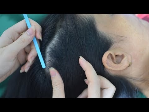 ASMR Focus Scalp Scratching, Hair Parting, Hair Combing Sounds For Relaxation ( No Talking )