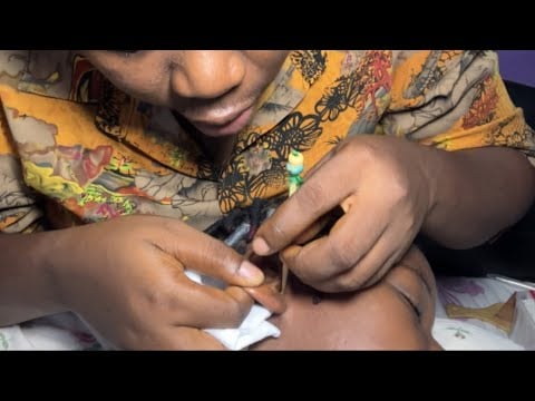ASMR✨SATISFYING EAR CLEANING