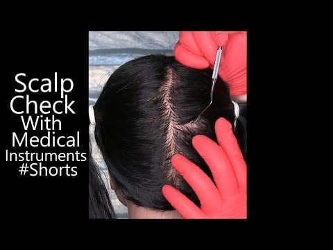 ASMR Scalp Check with Medical Instruments #Shorts