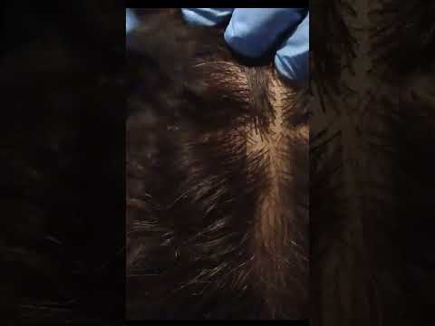 ASMR This Lice Check Will Give You Sooooo Many Tingles #shorts