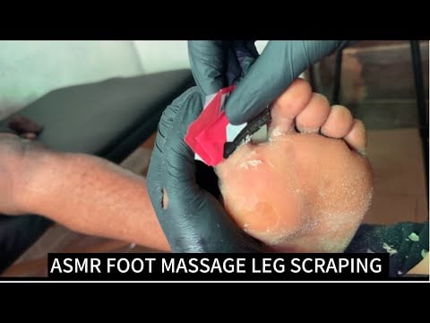 ASMR FOOT MASSAGE AND RELAXING PEDICURE, CORN REMOVAL AND NAILS CUTTING VERY RELAXING