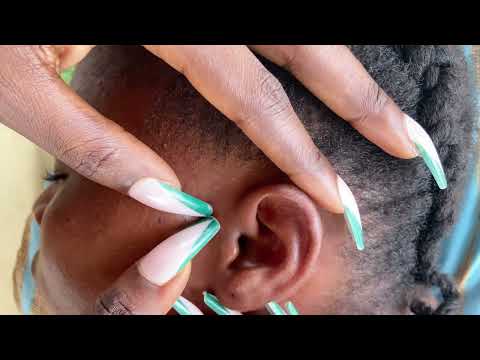 Asmr something stuck in you ear- ear cleaning real person