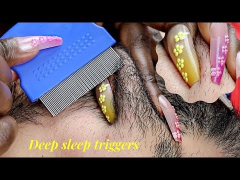 ASMR Immersive Beard Picking | SUPER ZOOM | Scratching, Checkup, Examination