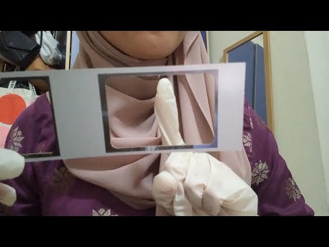 ASMR | Non sensical & Aggressive Eye Doctor RP (Checking your eye)