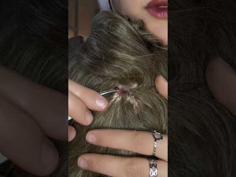 Bugs 🐜 #asmr #satisfying #relax #shorts
