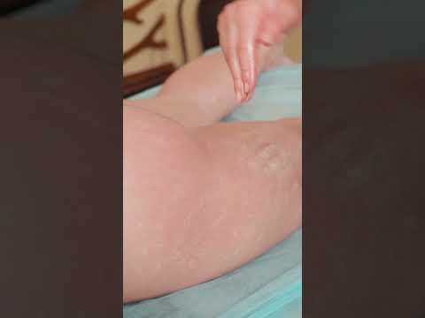 Sticky honey cellulite Asmr foot massage for Anna #cellulite