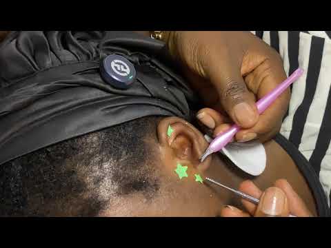 ASMR TINGLING EARCLEANING AND NITPICKING FOR DEEP SLEEP 😴 