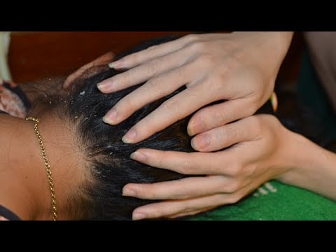 ASMR Scalp Check Real Person - Scalp Treatment Dandruff