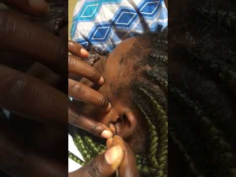 Ear Cleaning and nitpicking #satisfying #oddlysatisfying #earcleaning #earmassage