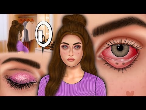 Eye infection Treatment | Eyelash Incident While Getting Ready |Removal of eye stone| ASMR animation