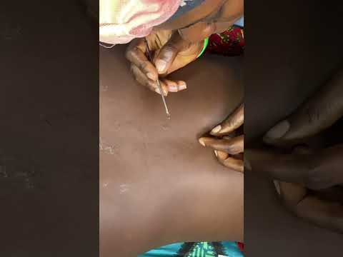ASMR BACK MASSAGE AND SCRATCHING FOR SLEEP #asmr #satisfying #backmassage #backscratch