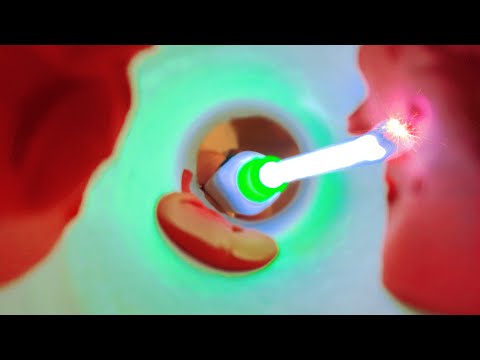 ASMR Deep Ear Cleaning - Big Earwax in your Ears